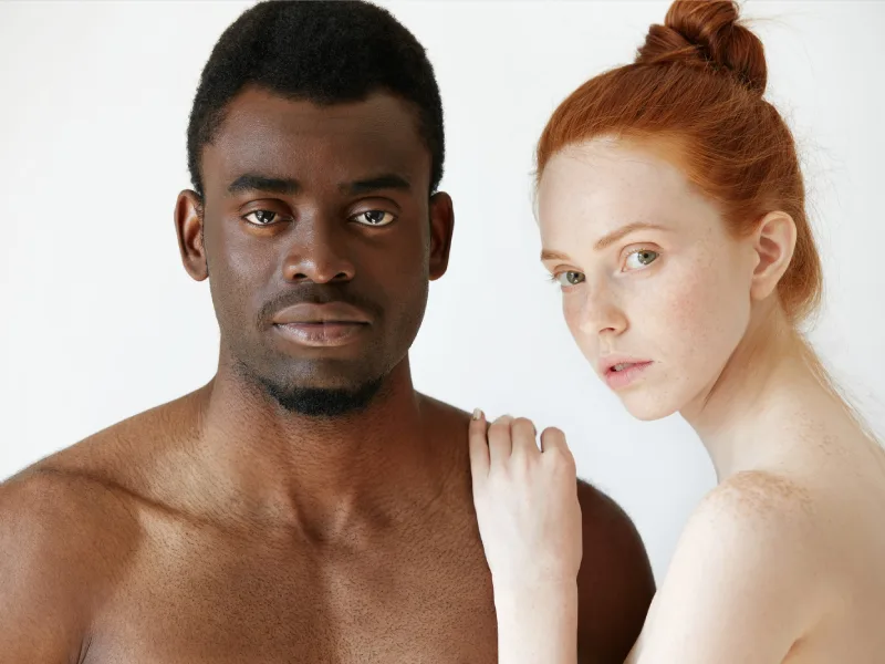 A man and a woman with different types of bags under the eyes